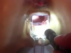 Wide open pussy with speculum